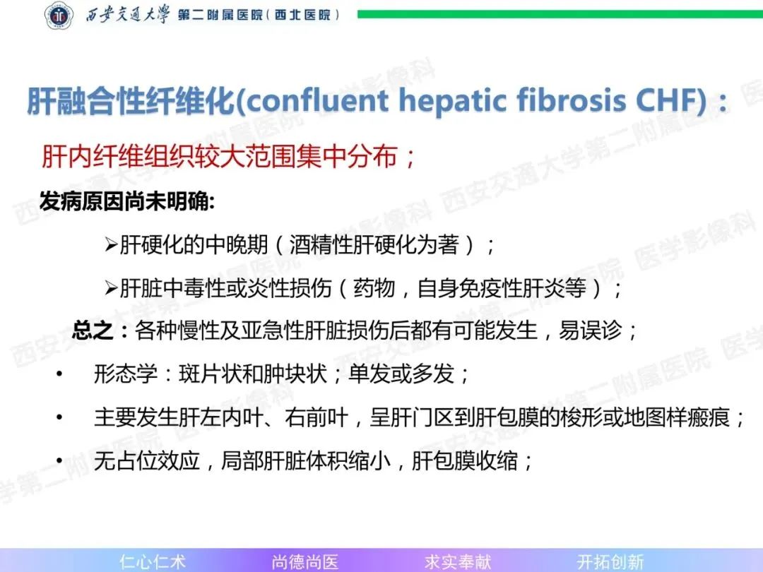 影像PPT - 【病例】肝融合性纤维化1例CT及MR影像-12