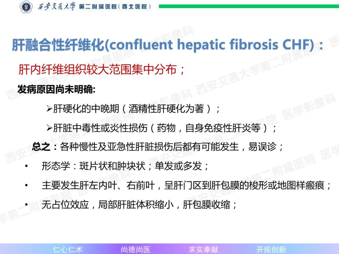 影像PPT - 【病例】肝融合性纤维化1例CT及MR影像-13