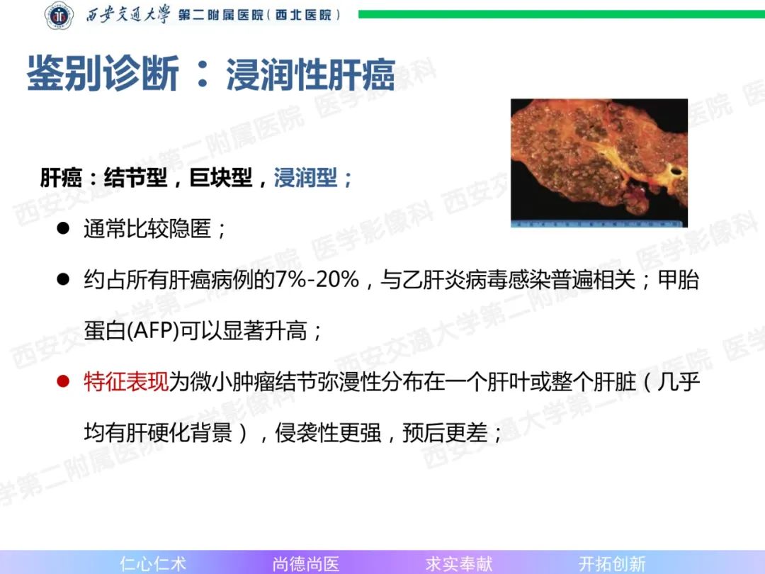 影像PPT - 【病例】肝融合性纤维化1例CT及MR影像-19
