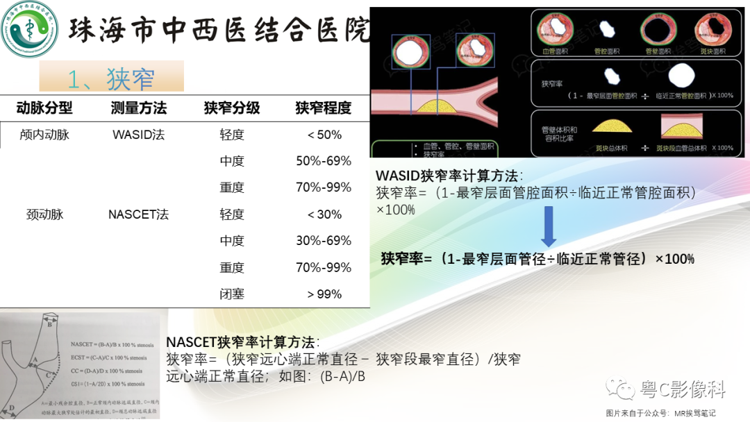 影像PPT - 【PPT】颅内MR血管壁高分辨成像的应用——中国专家共识-7