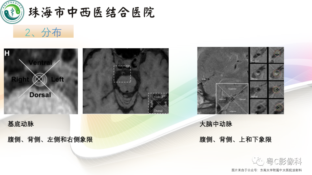 影像PPT - 【PPT】颅内MR血管壁高分辨成像的应用——中国专家共识-8