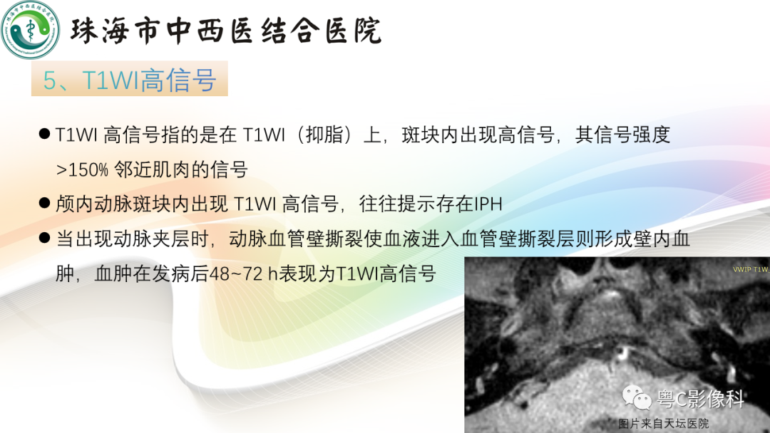 影像PPT - 【PPT】颅内MR血管壁高分辨成像的应用——中国专家共识-11