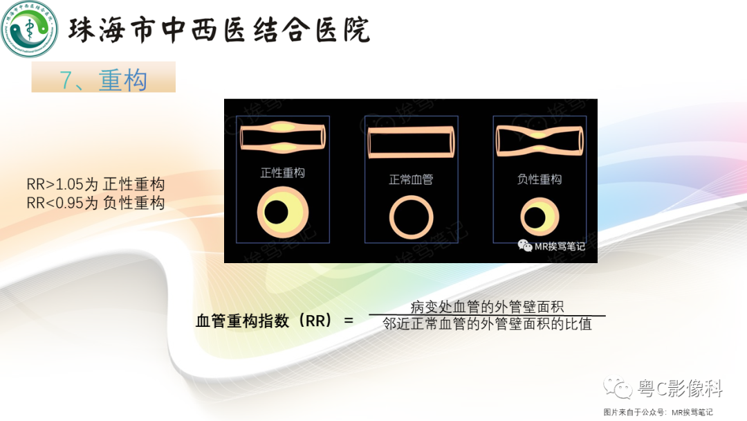影像PPT - 【PPT】颅内MR血管壁高分辨成像的应用——中国专家共识-13