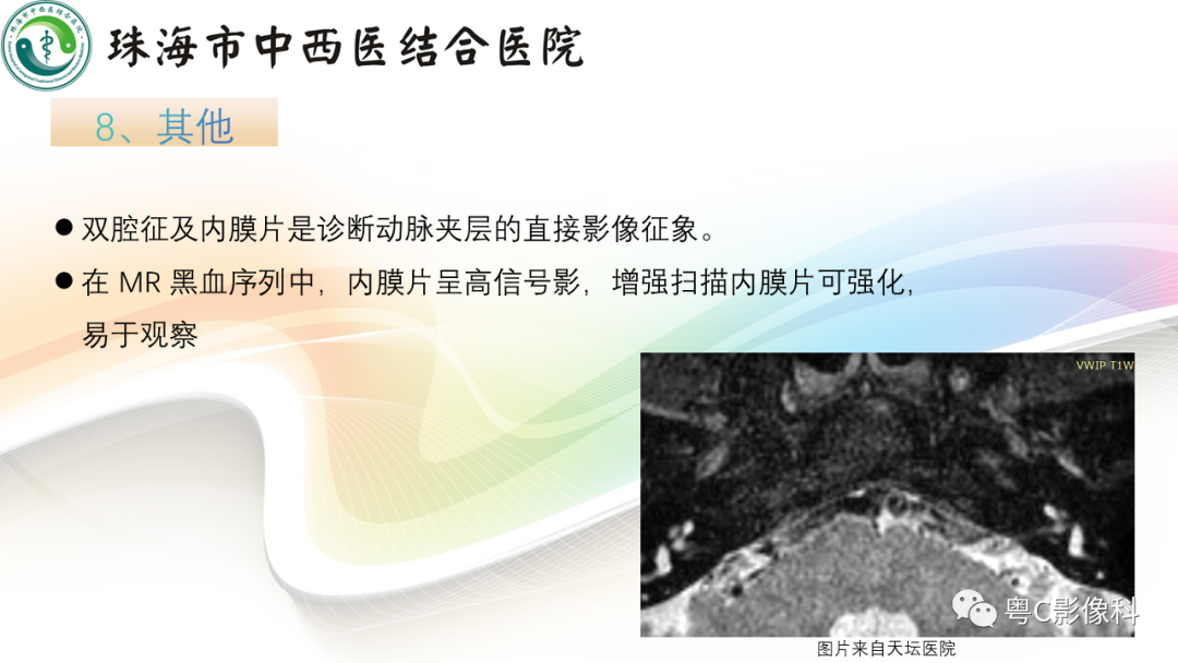 影像PPT - 【PPT】颅内MR血管壁高分辨成像的应用——中国专家共识-14