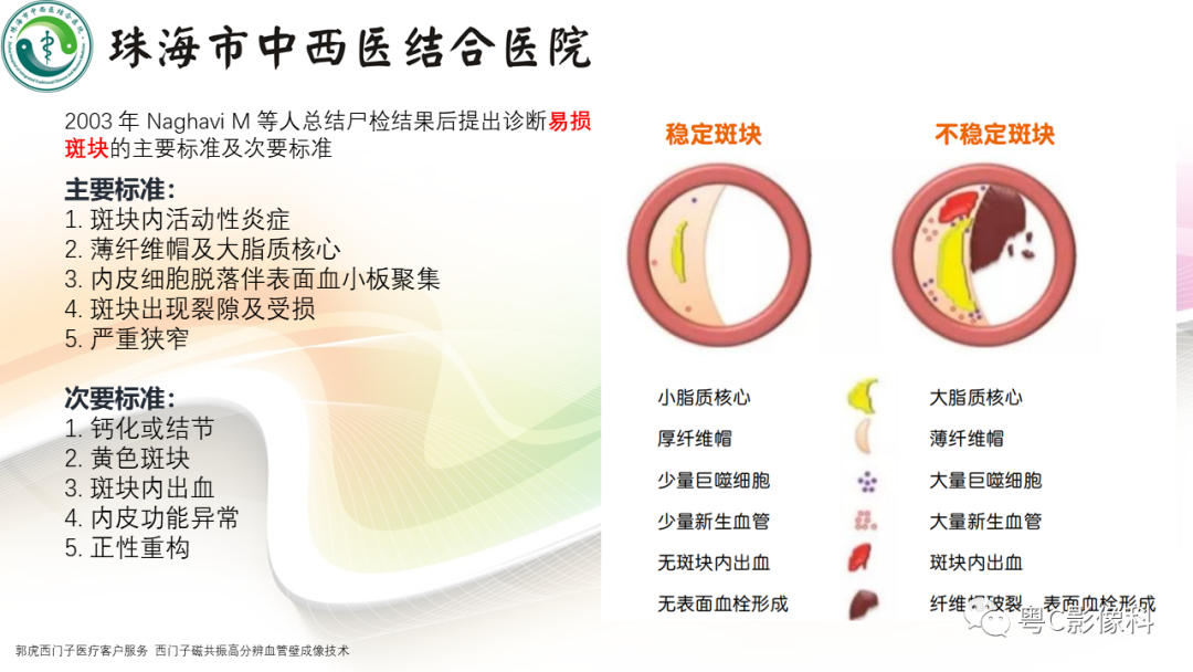 影像PPT - 【PPT】颅内MR血管壁高分辨成像的应用——中国专家共识-19