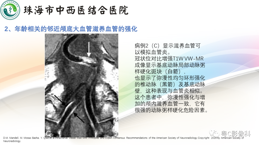影像PPT - 【PPT】颅内MR血管壁高分辨成像的应用——中国专家共识-31