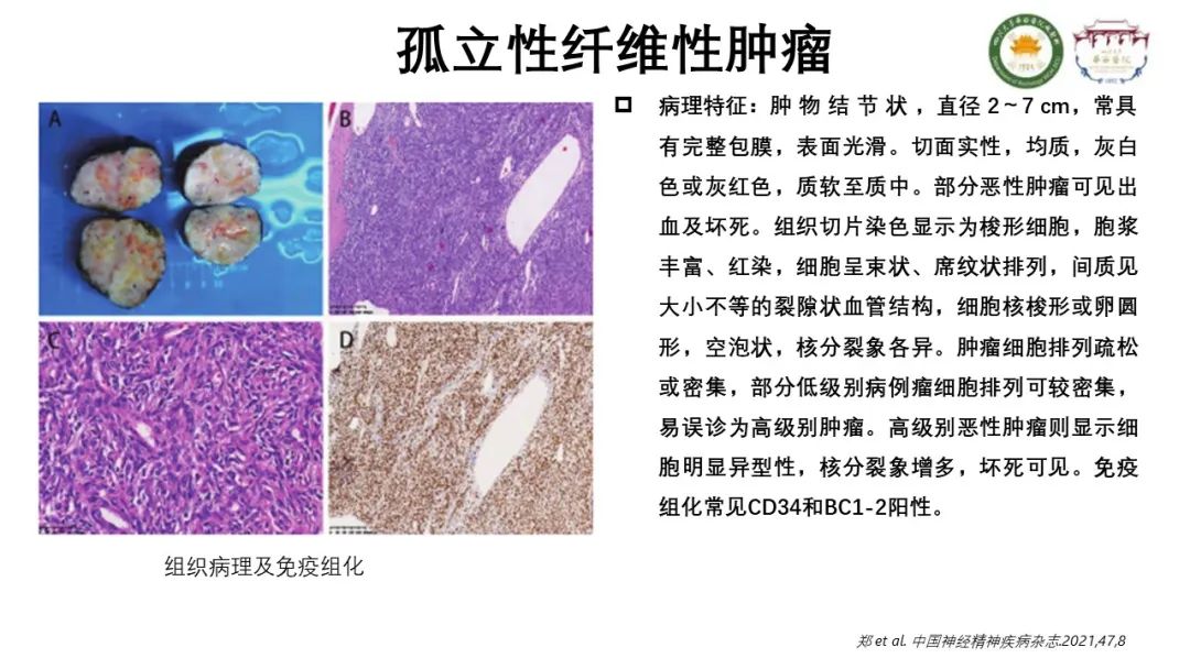 影像PPT - 【病例】颅内孤立性纤维性肿瘤1例MR影像-10