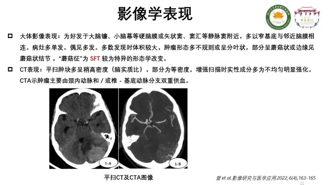 影像PPT - 【病例】颅内孤立性纤维性肿瘤1例MR影像-11