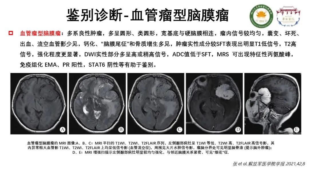 影像PPT - 【病例】颅内孤立性纤维性肿瘤1例MR影像-14