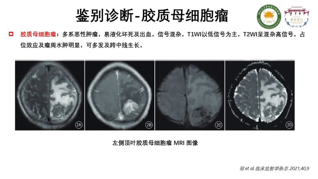 影像PPT - 【病例】颅内孤立性纤维性肿瘤1例MR影像-15