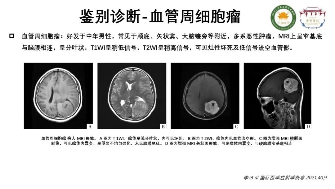 影像PPT - 【病例】颅内孤立性纤维性肿瘤1例MR影像-16