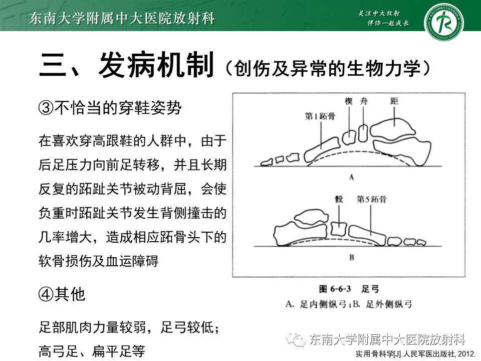 影像PPT - 【PPT】Freiberg病（跖骨头缺血性坏死）-9