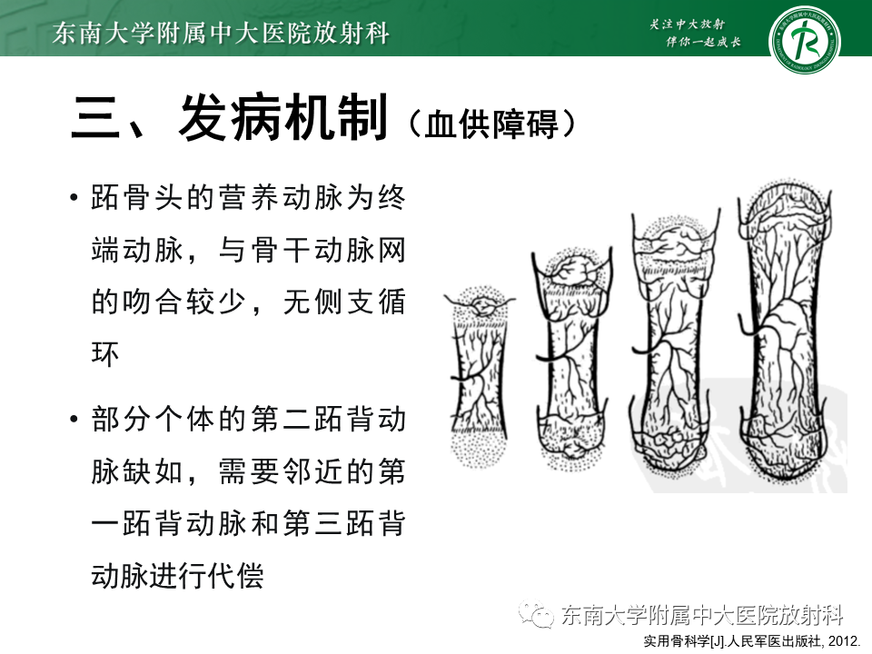 影像PPT - 【PPT】Freiberg病（跖骨头缺血性坏死）-11