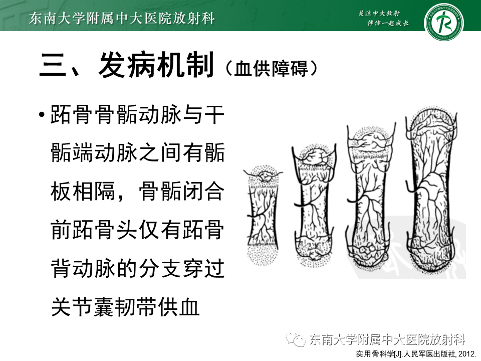 影像PPT - 【PPT】Freiberg病（跖骨头缺血性坏死）-12