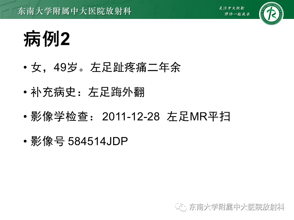 影像PPT - 【PPT】Freiberg病（跖骨头缺血性坏死）-25