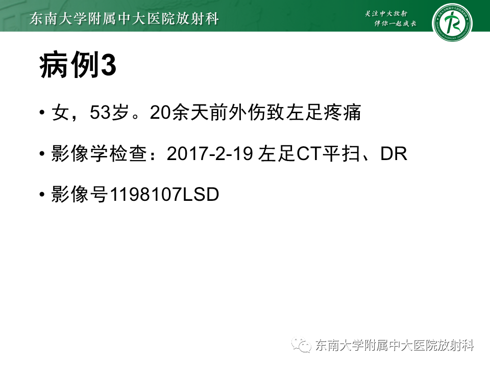 影像PPT - 【PPT】Freiberg病（跖骨头缺血性坏死）-27