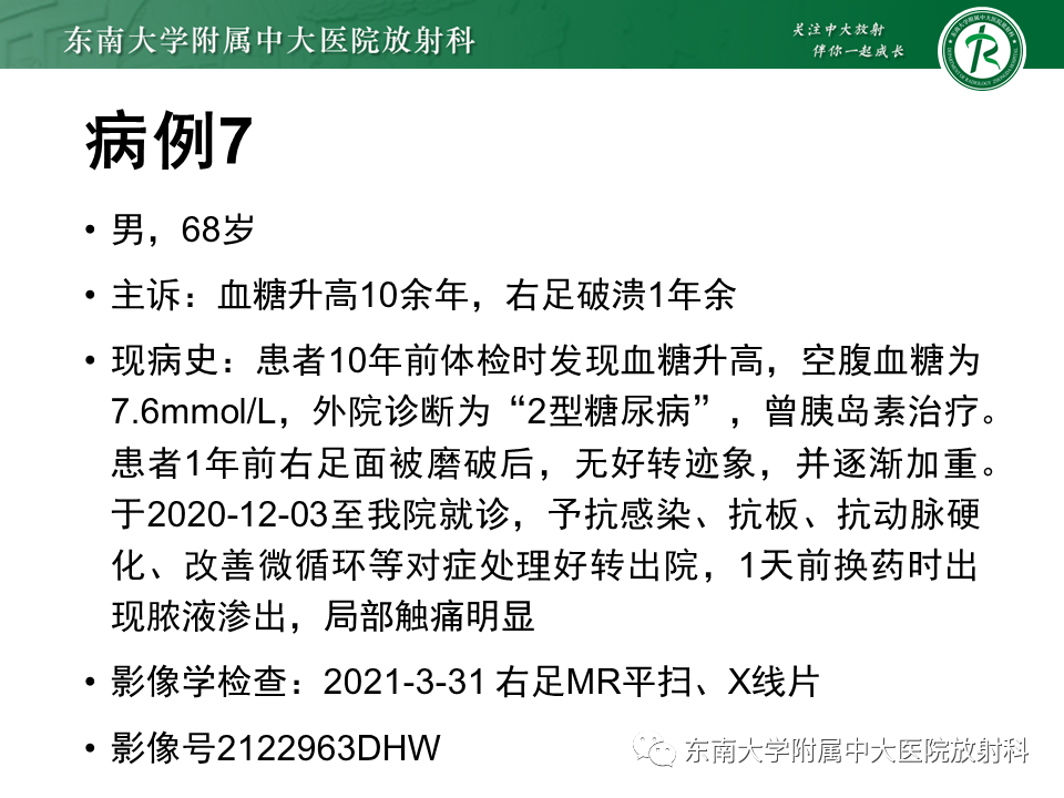 影像PPT - 【PPT】Freiberg病（跖骨头缺血性坏死）-59