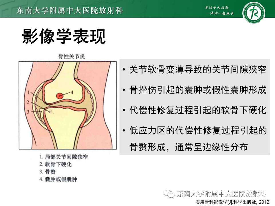 影像PPT - 【PPT】Freiberg病（跖骨头缺血性坏死）-63