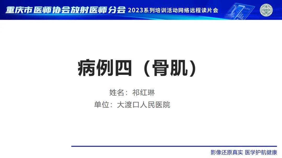 影像PPT - 【病例】腹股沟区横纹肌肉瘤1例CT影像-1