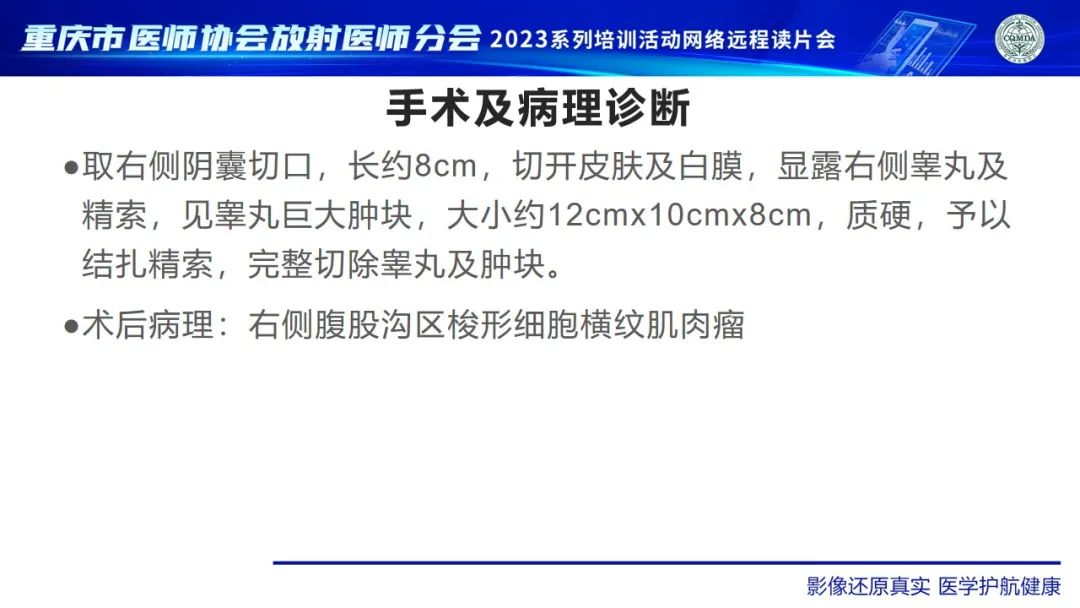 影像PPT - 【病例】腹股沟区横纹肌肉瘤1例CT影像-8