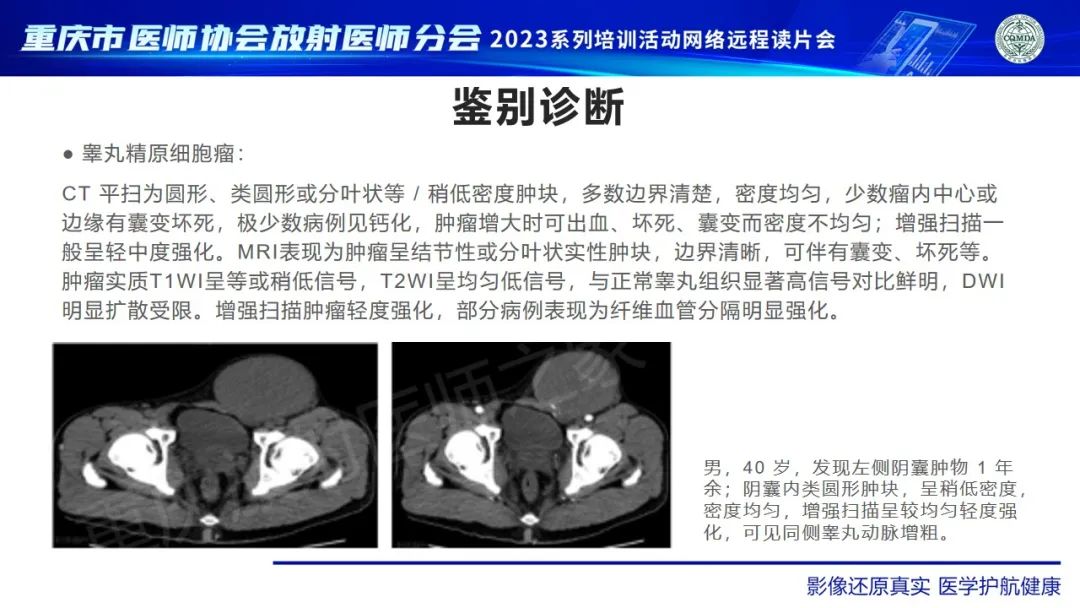 影像PPT - 【病例】腹股沟区横纹肌肉瘤1例CT影像-12