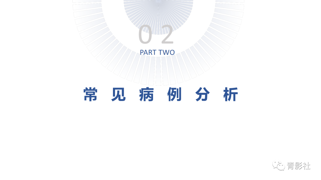影像PPT - 【PPT】桥小脑角区肿瘤的影像诊断-6