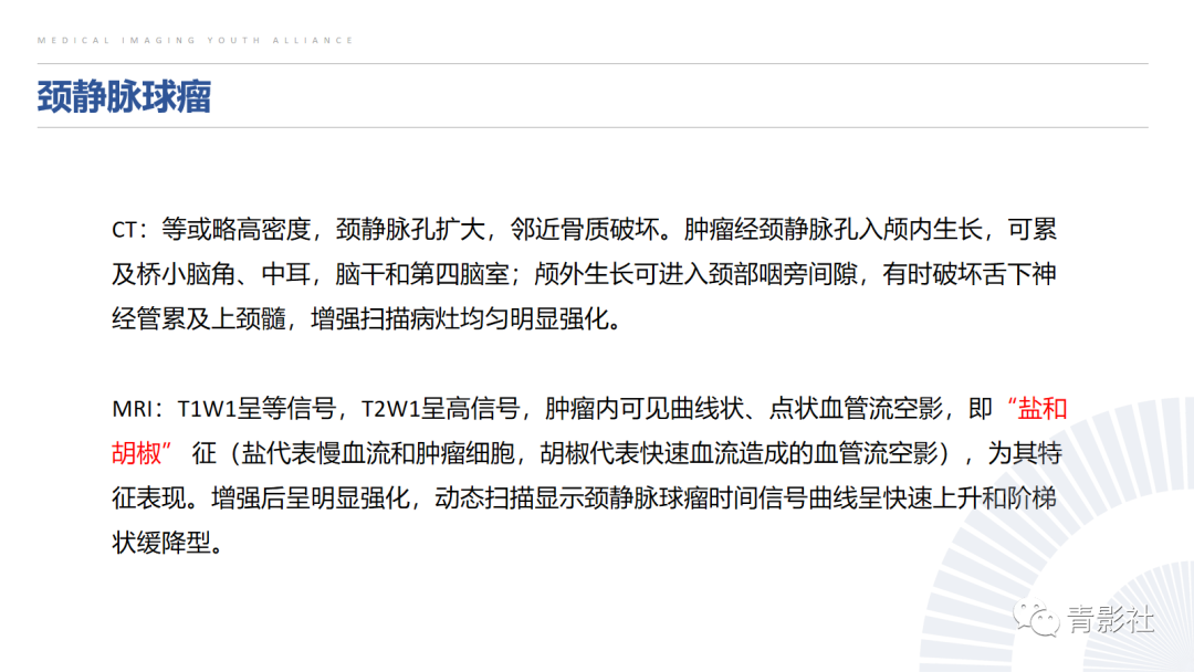 影像PPT - 【PPT】桥小脑角区肿瘤的影像诊断-29