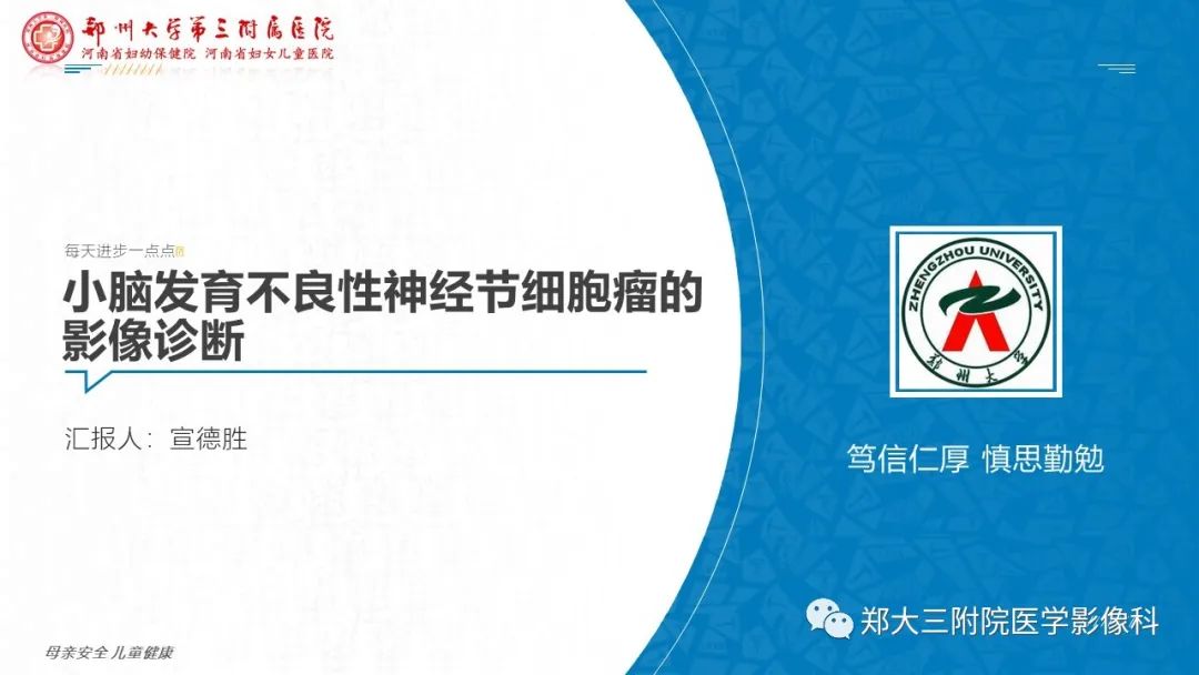 影像PPT - 【PPT】小脑发育不良性神经节细胞瘤的影像诊断-1