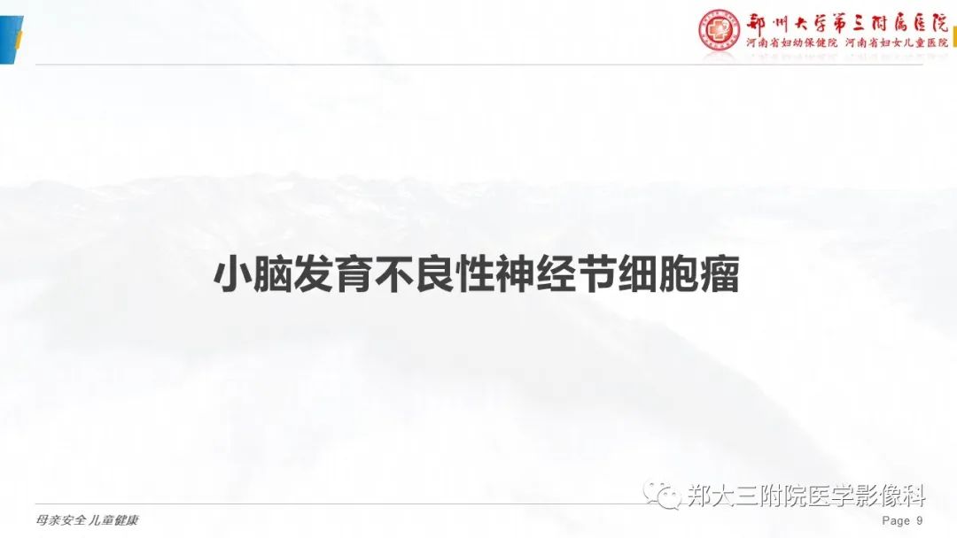 影像PPT - 【PPT】小脑发育不良性神经节细胞瘤的影像诊断-9