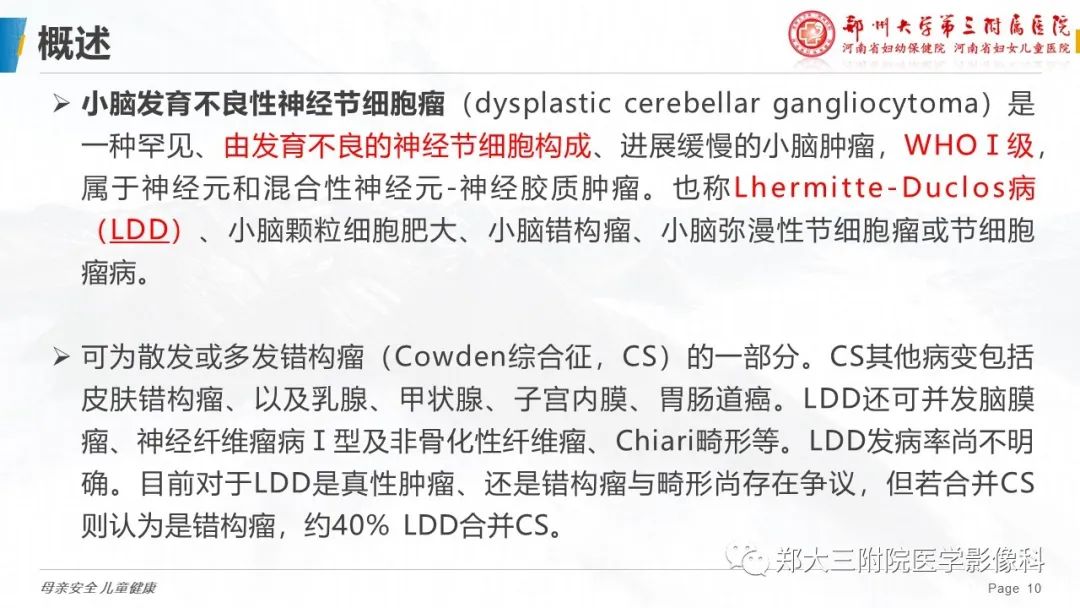 影像PPT - 【PPT】小脑发育不良性神经节细胞瘤的影像诊断-10