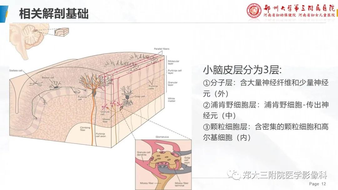 影像PPT - 【PPT】小脑发育不良性神经节细胞瘤的影像诊断-12