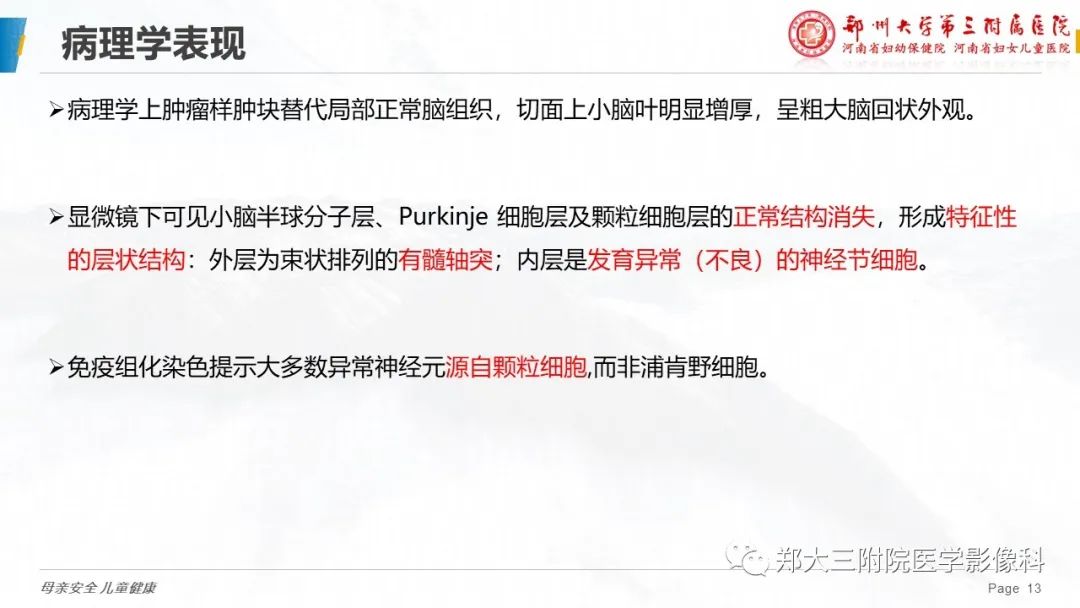 影像PPT - 【PPT】小脑发育不良性神经节细胞瘤的影像诊断-13