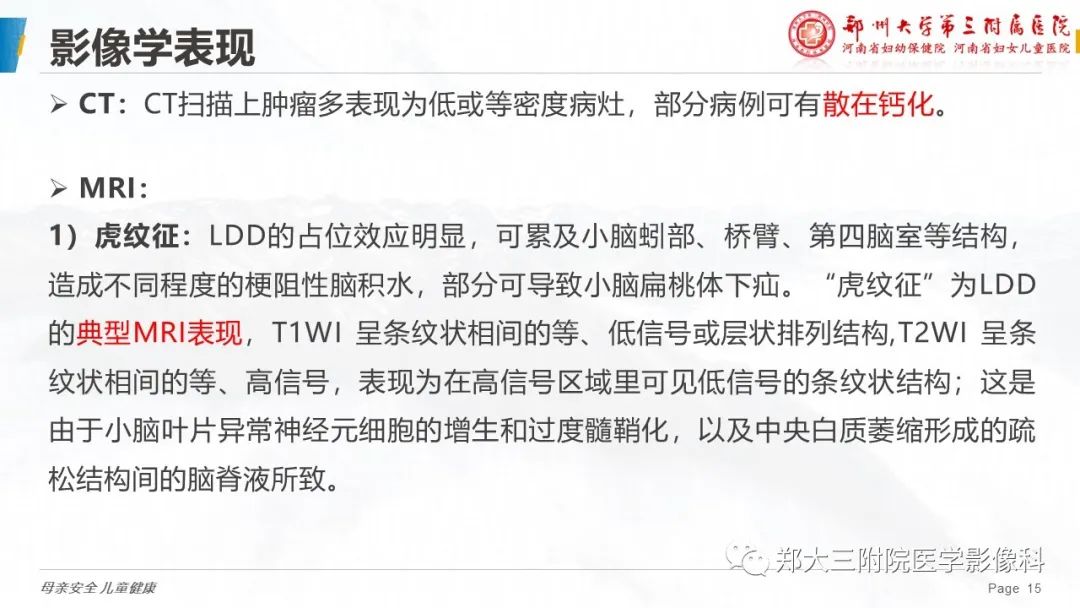 影像PPT - 【PPT】小脑发育不良性神经节细胞瘤的影像诊断-15