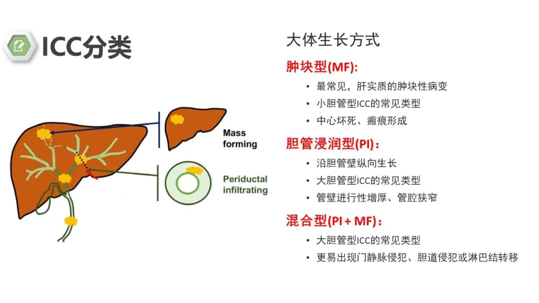 影像PPT - 【病例】肝内胆管癌1例CT及MR影像-13