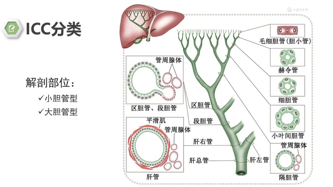 影像PPT - 【病例】肝内胆管癌1例CT及MR影像-14