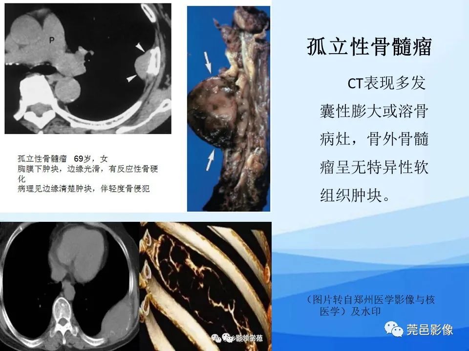 影像PPT - 【PPT】胸壁胸膜病变一例分享及文献学习-24