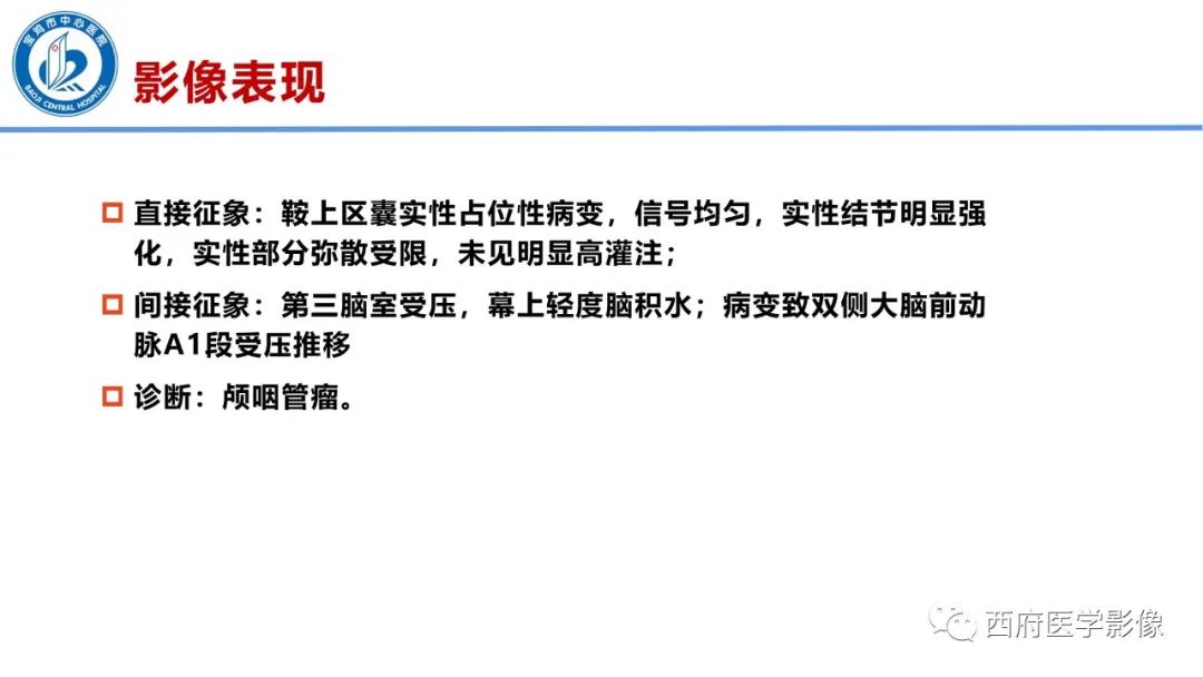 影像PPT - 【病例】鞍区囊性颅咽管瘤1例CT及MR影像诊断与鉴别-14