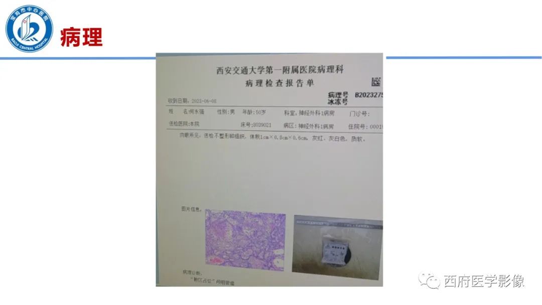 影像PPT - 【病例】鞍区囊性颅咽管瘤1例CT及MR影像诊断与鉴别-16