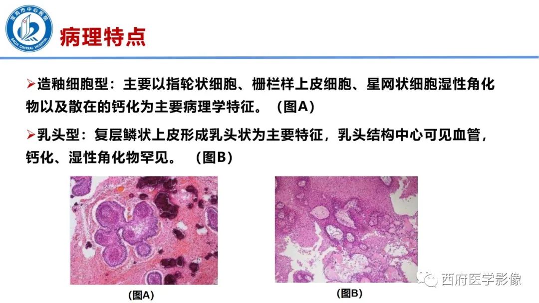 影像PPT - 【病例】鞍区囊性颅咽管瘤1例CT及MR影像诊断与鉴别-20