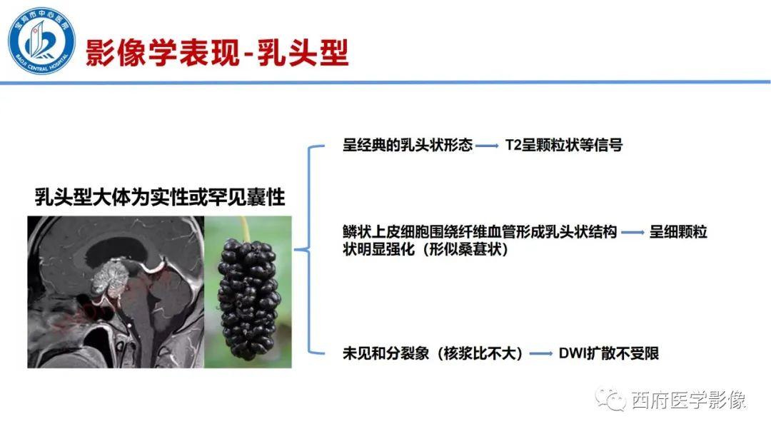 影像PPT - 【病例】鞍区囊性颅咽管瘤1例CT及MR影像诊断与鉴别-24