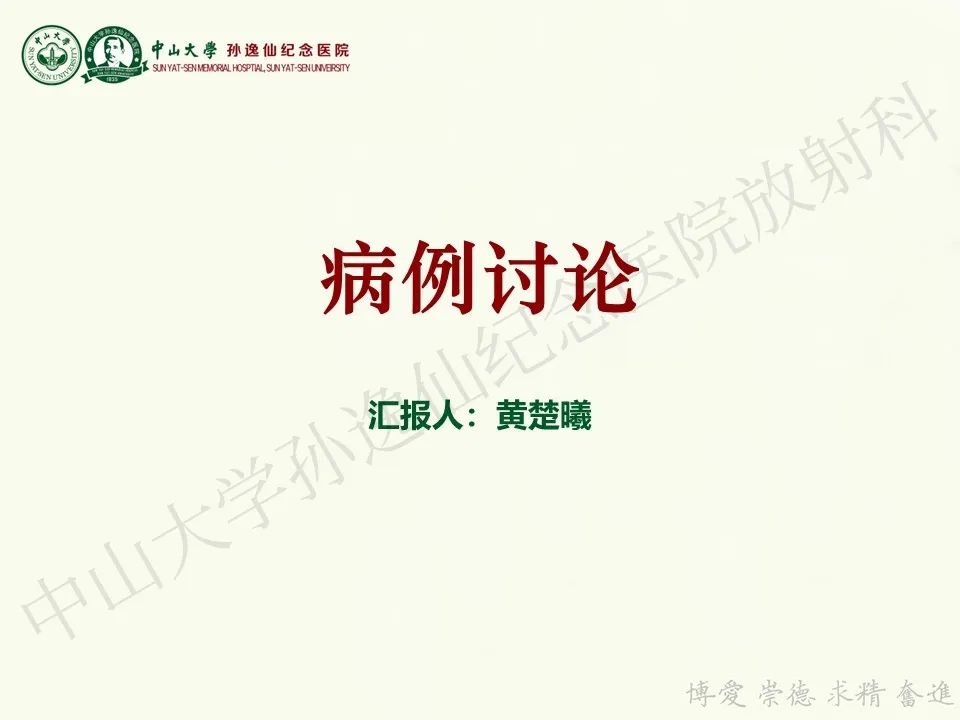 影像PPT - 【病例】脑干脱髓鞘假瘤1例CT及MR影像-1
