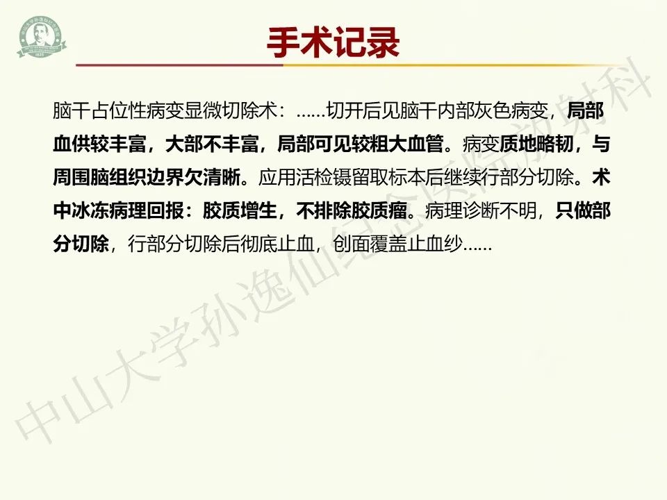 影像PPT - 【病例】脑干脱髓鞘假瘤1例CT及MR影像-10