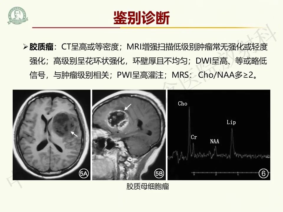 影像PPT - 【病例】脑干脱髓鞘假瘤1例CT及MR影像-23
