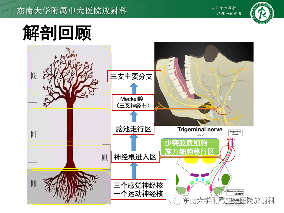 影像PPT - 【PPT】三叉神经痛相关影像诊断与评估-9