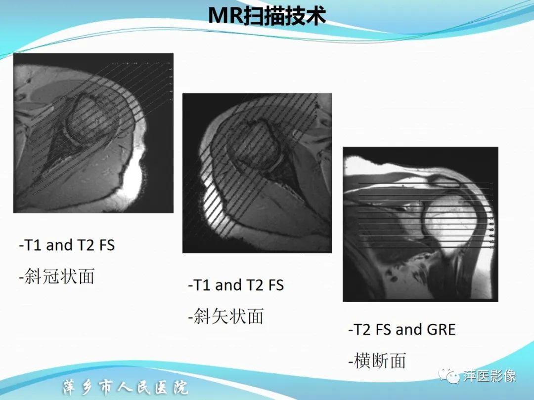 影像PPT - 【PPT】肩关节磁共振读片-4