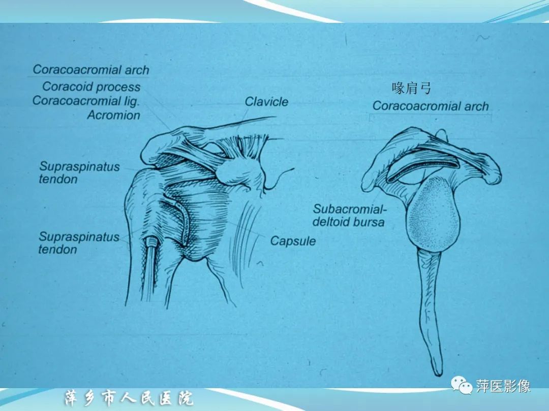 影像PPT - 【PPT】肩关节磁共振读片-6