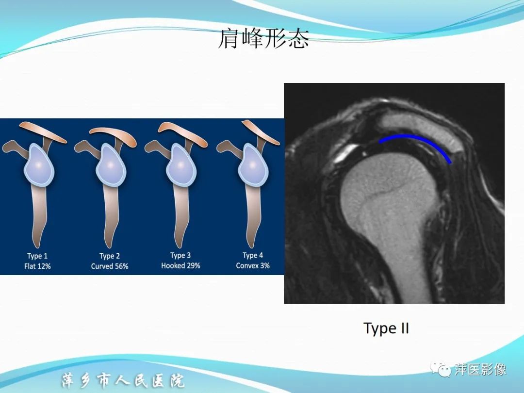 影像PPT - 【PPT】肩关节磁共振读片-11