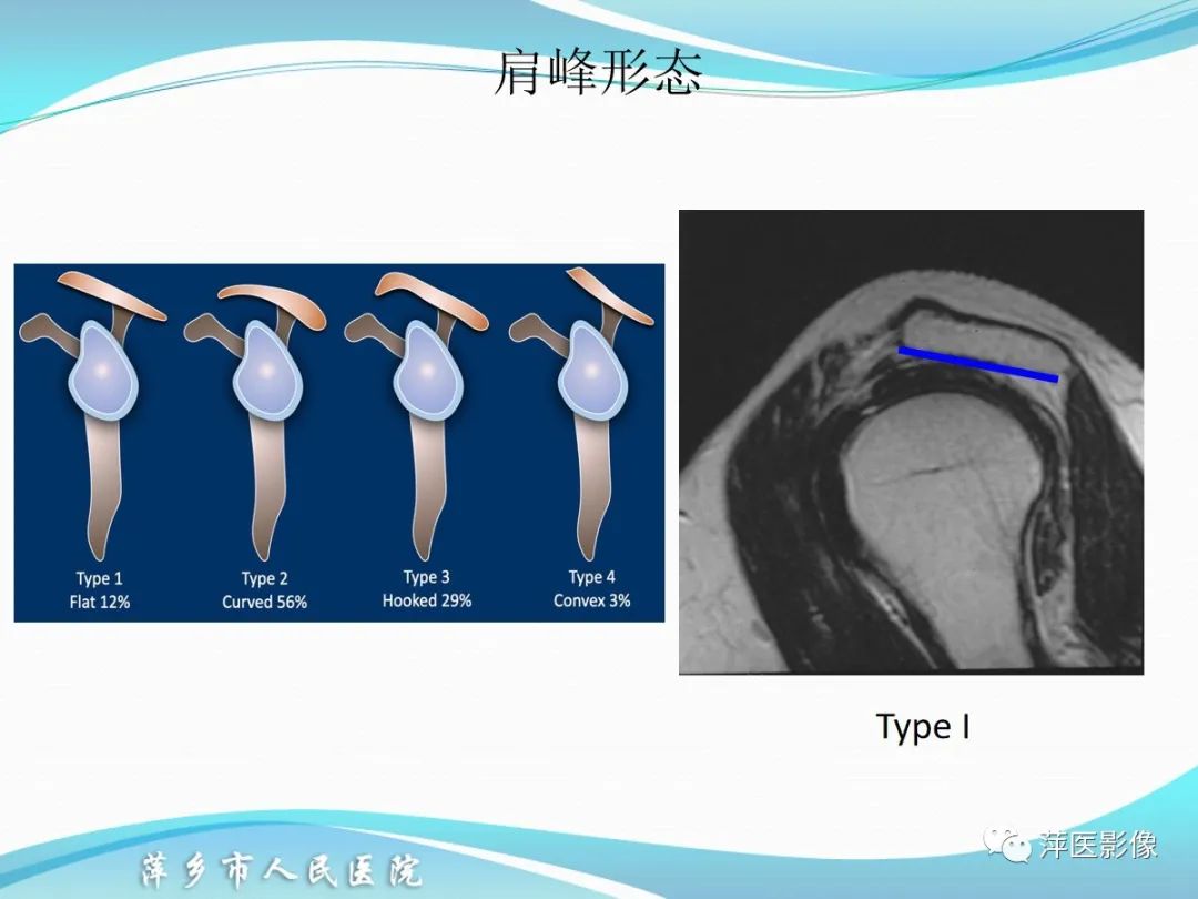 影像PPT - 【PPT】肩关节磁共振读片-10