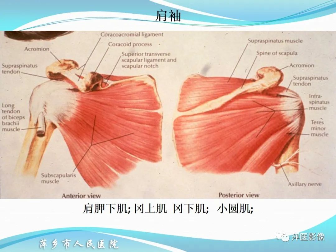 影像PPT - 【PPT】肩关节磁共振读片-24