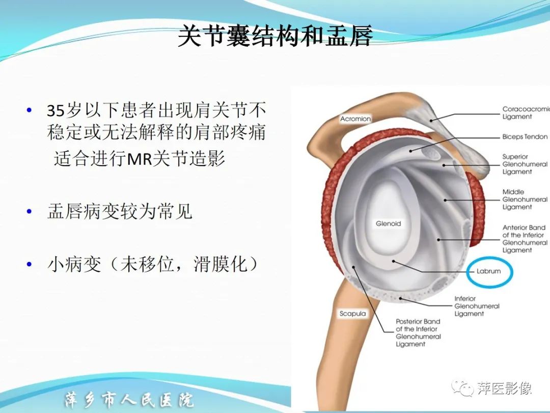 影像PPT - 【PPT】肩关节磁共振读片-46